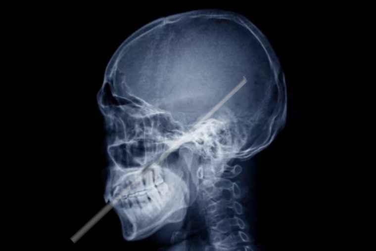 metal straw