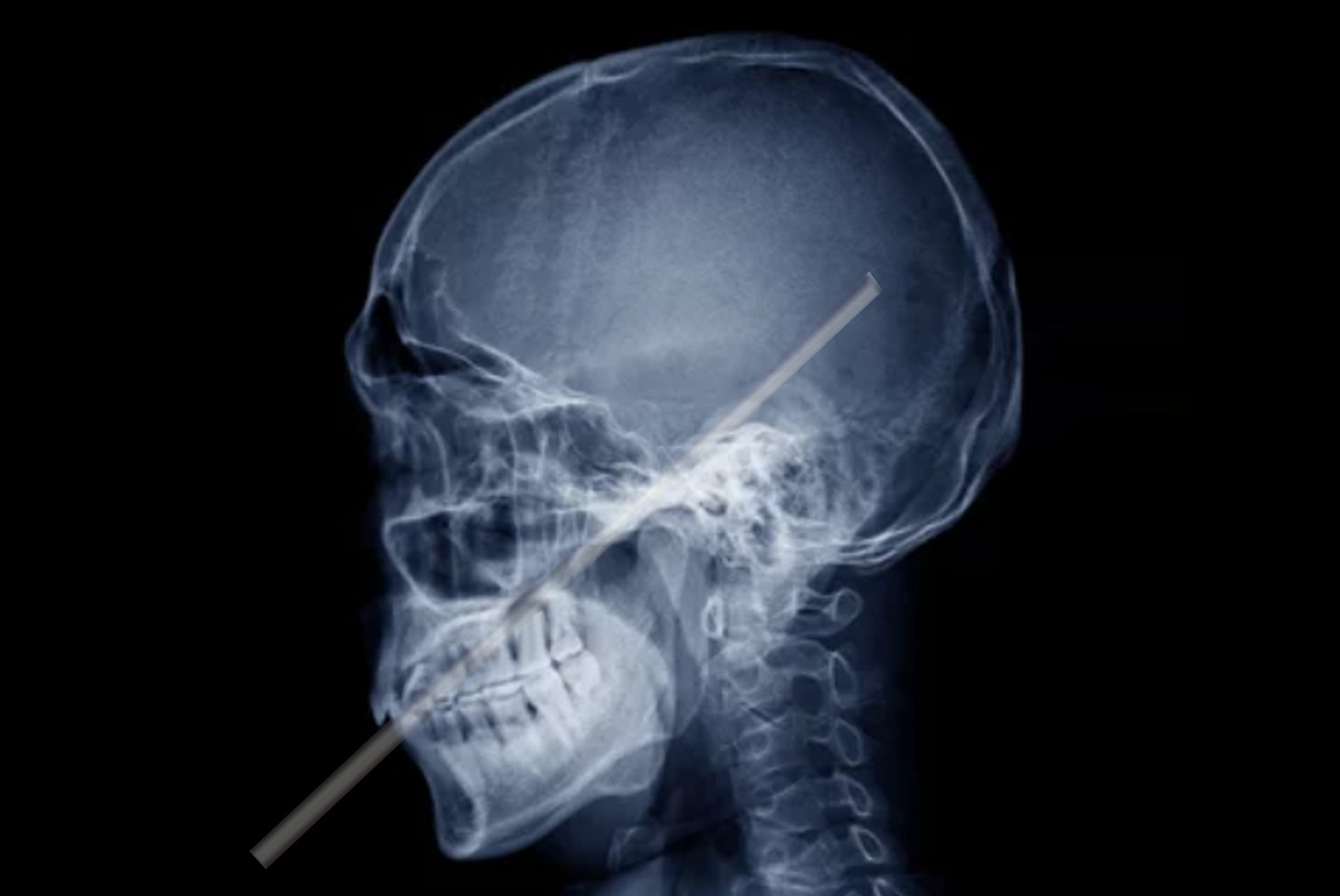 metal straw